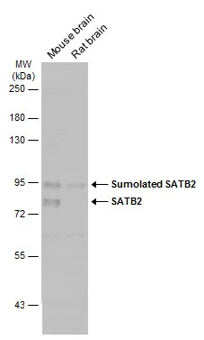 SATB2 antibody
