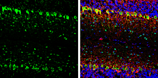 Parvalbumin antibody