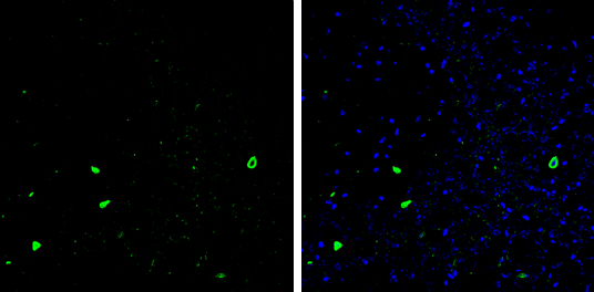 Parvalbumin antibody