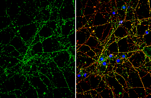 ROBO2 antibody