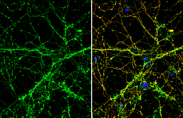 SLIT1 antibody detects SLIT1 protein by immunofluorescent analysis. Sample: DIV9 rat E18 primary cortical neuron cells were fixed in 4% paraformaldehyde at RT for 15 min. Green: SLIT1 stained by SLIT1 antibody (GTX134122) diluted at 1:500. Red: Tau, stained by Tau antibody [GT287] (GTX634809) diluted at 1:500. Blue: Fluoroshield with DAPI (GTX30920).