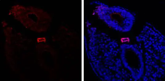 Brachyury antibody
