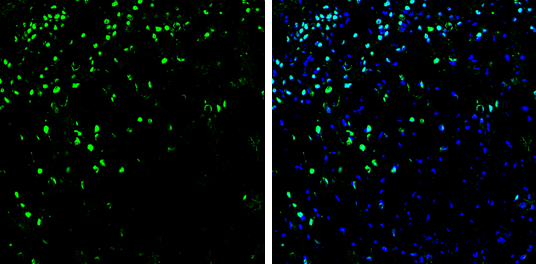 SATB2 antibody