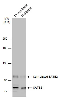 SATB2 antibody