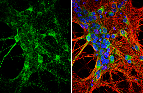 GluR1 antibody