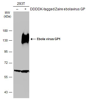 Non-transfected (–) and transfected (+) 293T whole cell extracts (30 μg) were separated by 7.5% SDS-PAGE, and the membrane was blotted with Ebola virus GP1 antibody (GTX134143) diluted at 1:5000. The HRP-conjugated anti-rabbit IgG antibody (GTX213110-01) was used to detect the primary antibody.