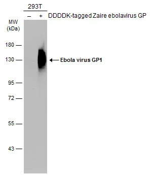 【限定150】ホアンコルネラ 「Humans Are A Virus」 【模写】 Anti-Ebola virus GP1 antibody (GTX134144) | GeneTex