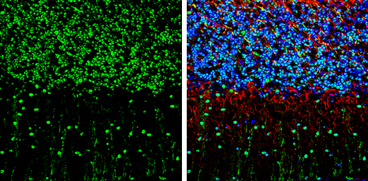 SMAD7 antibody detects SMAD7 protein by immunohistochemical analysis. Sample: Frozen-sectioned mouse mouse cerebellum. Green: SAMD7 stained by SMAD7 antibody (GTX134232) diluted at 1:250. Red: NF-H, stained by NF-H antibody [GT114] (GTX634289) diluted at 1:500. Blue: Fluoroshield with DAPI (GTX30920).