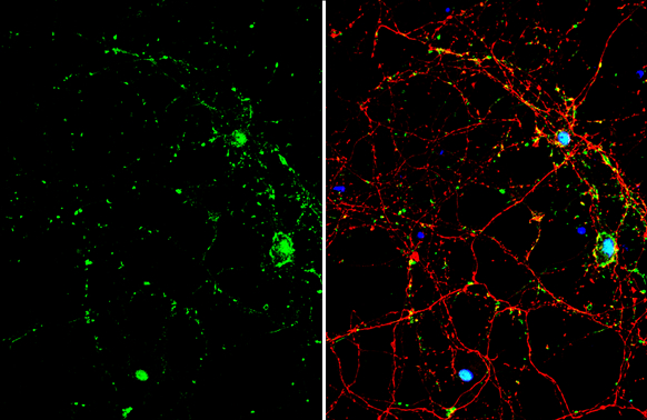 SMAD7 antibody detects SMAD7 protein by immunofluorescent analysis. Sample: DIV9 rat E18 primary cortical neuron cells were fixed in 4% paraformaldehyde at RT for 15 min. Green: SMAD7 stained by SMAD7 antibody (GTX134232) diluted at 1:500. Red: Tau, stained by Tau antibody [GT287] (GTX634809) diluted at 1:500. Blue: Fluoroshield with DAPI (GTX30920).