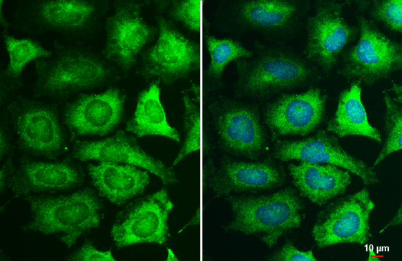 MEK1 antibody detects MEK1 protein at cytoplasm by immunofluorescent analysis. Sample: HeLa cells were fixed in 4% paraformaldehyde at RT for 15 min. Green: MEK1 stained by MEK1 antibody (GTX134234) diluted at 1:500. Blue: Hoechst 33342 staining. Scale bar= 10 μm. MEK1 antibody detects MEK1 protein at cytoplasm by immunofluorescent analysis. Sample: HeLa cells were fixed in 4% paraformaldehyde at RT for 15 min. Green: MEK1 stained by MEK1 antibody (GTX134234) diluted at 1:500. Blue: Hoechst 33342 staining. Scale bar= 10 μm.