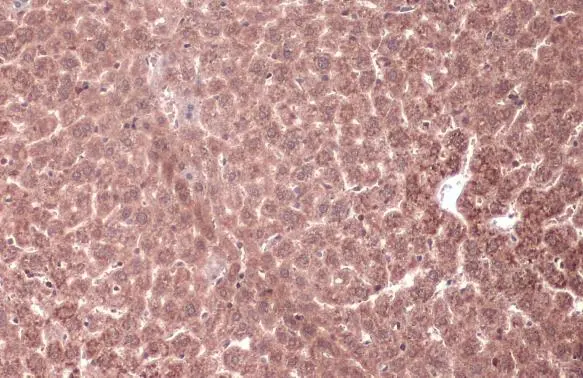 MEK1 antibody detects MEK1 protein at cytoplasm by immunohistochemical analysis. Sample: Paraffin-embedded mouse liver. MEK1 stained by MEK1 antibody (GTX134234) diluted at 1:1000. Antigen Retrieval: Citrate buffer, pH 6.0, 15 min MEK1 antibody detects MEK1 protein at cytoplasm by immunohistochemical analysis. Sample: Paraffin-embedded mouse liver. MEK1 stained by MEK1 antibody (GTX134234) diluted at 1:1000. Antigen Retrieval: Citrate buffer, pH 6.0, 15 min