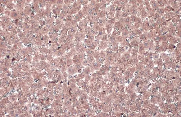 MEK1 antibody detects MEK1 protein at cytoplasm by immunohistochemical analysis. Sample: Paraffin-embedded rat liver. MEK1 stained by MEK1 antibody (GTX134234) diluted at 1:1000. Antigen Retrieval: Citrate buffer, pH 6.0, 15 min MEK1 antibody detects MEK1 protein at cytoplasm by immunohistochemical analysis. Sample: Paraffin-embedded rat liver. MEK1 stained by MEK1 antibody (GTX134234) diluted at 1:1000. Antigen Retrieval: Citrate buffer, pH 6.0, 15 min