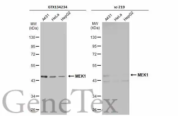 Various whole cell extracts (30 μg) were separated by 10% SDS-PAGE, and the membranes were blotted with MEK1 antibody (GTX134234) diluted at 1:500 and competitor's antibody (sc-219) diluted at 1:500. The HRP-conjugated anti-rabbit IgG antibody (GTX213110-01) was used to detect the primary antibody, and the signal was developed with Trident ECL plus-Enhanced. *The competitor is not affiliated with GeneTex and does not endorse this product. Various whole cell extracts (30 μg) were separated by 10% SDS-PAGE, and the membranes were blotted with MEK1 antibody (GTX134234) diluted at 1:500 and competitor's antibody (sc-219) diluted at 1:500. The HRP-conjugated anti-rabbit IgG antibody (GTX213110-01) was used to detect the primary antibody, and the signal was developed with Trident ECL plus-Enhanced. *The competitor is not affiliated with GeneTex and does not endorse this product.