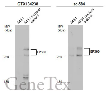 A431 whole cell and nuclear extracts (30 μg) were separated by 5% SDS-PAGE, and the membranes were blotted with EP300 antibody (GTX134238) diluted at 1:500 and competitor's antibody (sc-584) diluted at 1:100. The HRP-conjugated anti-rabbit IgG antibody (GTX213110-01) was used to detect the primary antibody. *The competitor is not affiliated with GeneTex and does not endorse this product.