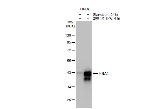 Untreated (–) and treated (+) HeLa whole cell extracts (30 μg) were separated by 10% SDS-PAGE, and the membrane was blotted with FRA1 antibody (GTX134242) diluted at 1:1000. The HRP-conjugated anti-rabbit IgG antibody (GTX213110-01) was used to detect the primary antibody.