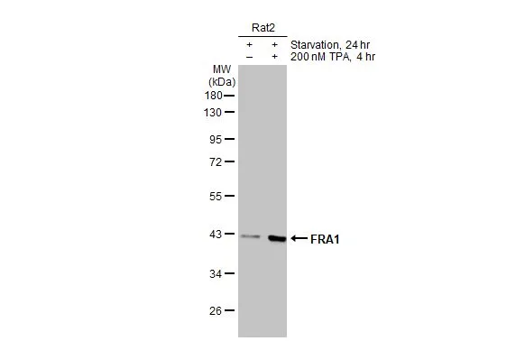 Untreated (–) and treated (+) Rat-2 whole cell extracts (30 μg) were separated by 10% SDS-PAGE, and the membrane was blotted with FRA1 antibody (GTX134242) diluted at 1:1000. The HRP-conjugated anti-rabbit IgG antibody (GTX213110-01) was used to detect the primary antibody.