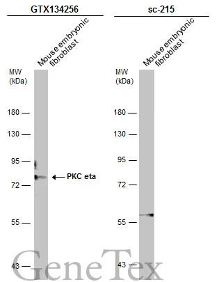 PKC eta antibody