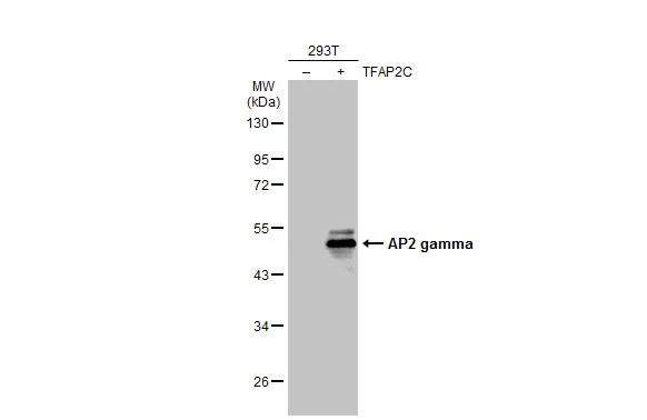 Non-transfected (–) and transfected (+) 293T whole cell extracts (30 μg) were separated by 10% SDS-PAGE, and the membrane was blotted with AP2 gamma antibody (GTX134259) diluted at 1:1000. The HRP-conjugated anti-rabbit IgG antibody (GTX213110-01) was used to detect the primary antibody.