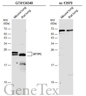 Various tissue extracts (50 μg) were separated by 15% SDS-PAGE, and the membranes were blotted with SFTPC antibody (GTX134340) diluted at 1:1000 and competitor's antibody (sc-13979) diluted at 1:100. The HRP-conjugated anti-rabbit IgG antibody (GTX213110-01) was used to detect the primary antibody. *The competitor is not affiliated with GeneTex and does not endorse this product.