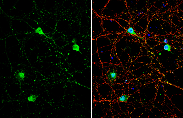 GNAT2 antibody detects GNAT2 protein by immunofluorescent analysis. Sample: DIV9 rat E18 primary cortical neuron cells were fixed in 4% paraformaldehyde at RT for 15 min. Green: GNAT2 stained by GNAT2 antibody (GTX134342) diluted at 1:500. Red: Tau, stained by Tau antibody [GT287] (GTX634809) diluted at 1:500. Blue: Fluoroshield with DAPI (GTX30920).