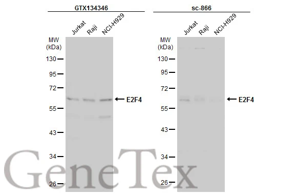 Various whole cell extracts (30 μg) were separated by 10% SDS-PAGE, and the membranes were blotted with E2F4 antibody (GTX134346) diluted at 1:1000 and competitor's antibody (sc-866) diluted at 1:100. The HRP-conjugated anti-rabbit IgG antibody (GTX213110-01) was used to detect the primary antibody, and the signal was developed with Trident ECL plus-Enhanced. *The competitor is not affiliated with GeneTex and does not endorse this product.