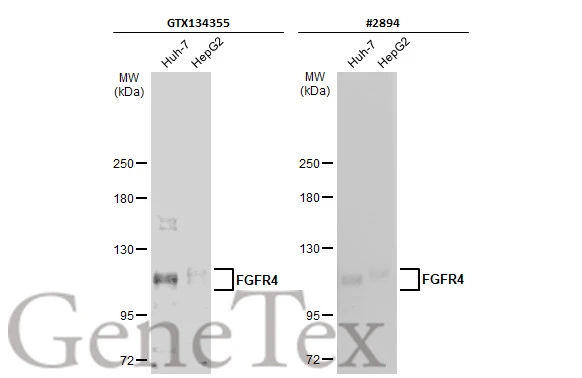 Various whole cell extracts (30 μg) were separated by 5% SDS-PAGE, and the membranes were blotted with FGFR4 antibody (GTX134355) diluted at 1:500 and competitor's antibody (#2894) diluted at 1:500. The HRP-conjugated anti-rabbit IgG antibody (GTX213110-01) was used to detect the primary antibody. *The competitor is not affiliated with GeneTex and does not endorse this product.