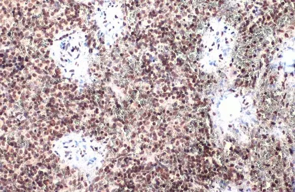 IRF3 (phospho Ser396) antibody detects IRF3 (phospho Ser396) protein at nucleus by immunohistochemical analysis. Sample: Paraffin-embedded mouse spleen. IRF3 (phospho Ser396) stained by IRF3 (phospho Ser396) antibody (GTX134360) diluted at 1:500. Antigen Retrieval: Citrate buffer, pH 6.0, 15 min