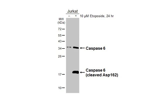 Untreated (–) and treated (+) Jurkat whole cell extract (30 μg) were separated by 12% SDS-PAGE, and the membrane was blotted with Caspase 6 antibody (GTX134362) diluted at 1:1000. The HRP-conjugated anti-rabbit IgG antibody (GTX213110-01) was used to detect the primary antibody.