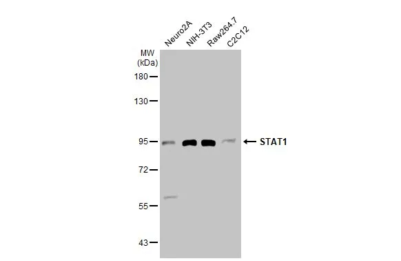 Various whole cell extracts (30 μg) were separated by 7.5% SDS-PAGE, and the membrane was blotted with STAT1 antibody (GTX134371) diluted at 1:1000. The HRP-conjugated anti-rabbit IgG antibody (GTX213110-01) was used to detect the primary antibody. Various whole cell extracts (30 μg) were separated by 7.5% SDS-PAGE, and the membrane was blotted with STAT1 antibody (GTX134371) diluted at 1:1000. The HRP-conjugated anti-rabbit IgG antibody (GTX213110-01) was used to detect the primary antibody.