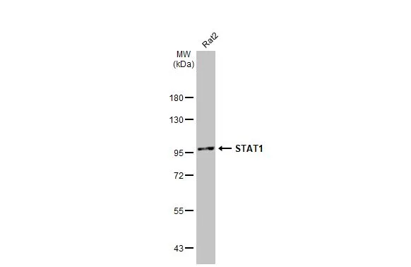 Whole cell extract (30 μg) was separated by 7.5% SDS-PAGE, and the membrane was blotted with STAT1 antibody (GTX134371) diluted at 1:1000. The HRP-conjugated anti-rabbit IgG antibody (GTX213110-01) was used to detect the primary antibody. Whole cell extract (30 μg) was separated by 7.5% SDS-PAGE, and the membrane was blotted with STAT1 antibody (GTX134371) diluted at 1:1000. The HRP-conjugated anti-rabbit IgG antibody (GTX213110-01) was used to detect the primary antibody.