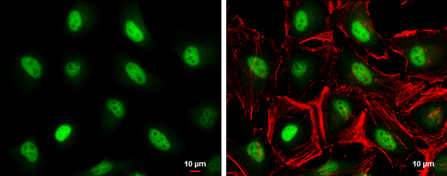 c-Jun antibody detects c-Jun protein at nucleus by immunofluorescent analysis. Sample: HeLa cells were fixed in 4% paraformaldehyde at RT for 15 min. Green: c-Jun stained by c-Jun antibody (GTX134395) diluted at 1:1000. Red: phalloidin, a cytoskeleton marker, diluted at 1:100. Scale bar= 10μm.