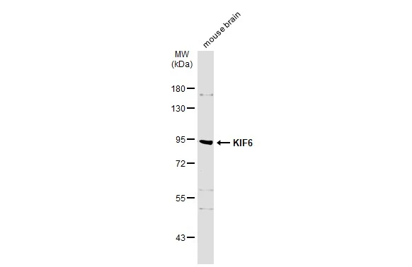 Mouse tissue extract (50 μg) was separated by 7.5% SDS-PAGE, and the membrane was blotted with KIF6 antibody (GTX134401) diluted at 1:1000. The HRP-conjugated anti-rabbit IgG antibody (GTX213110-01) was used to detect the primary antibody.