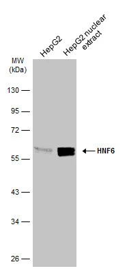 HepG2 whole cell and nuclear extracts (30 μg) were separated by 10% SDS-PAGE, and the membrane was blotted with HNF6 antibody (GTX134403) diluted at 1:1000. The HRP-conjugated anti-rabbit IgG antibody (GTX213110-01) was used to detect the primary antibody.