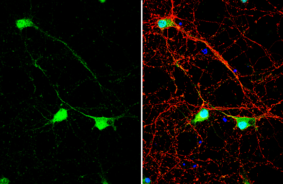NHERF1 antibody detects NHERF1 protein by immunofluorescent analysis. Sample: DIV10 rat E18 primary cortical neuron cells were fixed in 4% paraformaldehyde at RT for 15 min. Green: NHERF1 stained by NHERF1 antibody (GTX134431) diluted at 1:500. Red: Tau, stained by Tau antibody [GT287] (GTX634809) diluted at 1:500. Blue: Fluoroshield with DAPI (GTX30920).