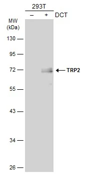 Non-transfected (–) and transfected (+) 293T whole cell extracts (30 μg) were separated by 10% SDS-PAGE, and the membrane was blotted with TRP2 antibody (GTX134445) diluted at 1:5000. The HRP-conjugated anti-rabbit IgG antibody (GTX213110-01) was used to detect the primary antibody, and the signal was developed with Trident ECL plus-Enhanced.