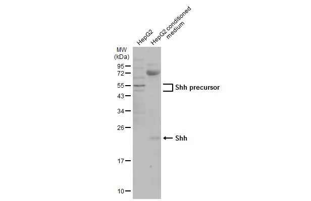 HepG2 whole cell extract and conditioned medium (30 μg) were separated by 12% SDS-PAGE, and the membrane was blotted with Shh antibody (GTX134453) diluted at 1:500. The HRP-conjugated anti-rabbit IgG antibody (GTX213110-01) was used to detect the primary antibody, and the signal was developed with Trident ECL plus-Enhanced.