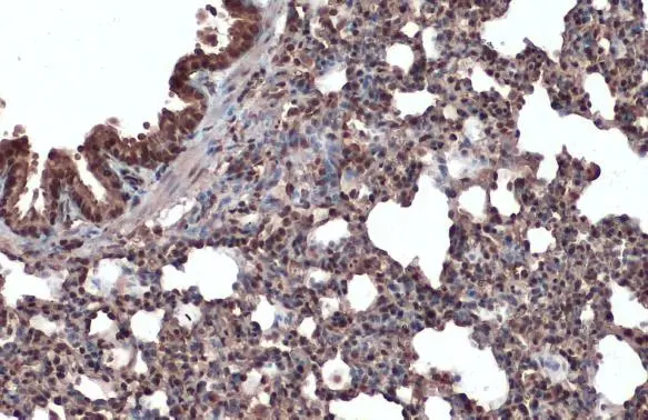 ERK2 antibody detects ERK2 protein at cytoplasm and nucleus by immunohistochemical analysis. Sample: Paraffin-embedded mouse lung. ERK2 stained by ERK2 antibody (GTX134457) diluted at 1:500. Antigen Retrieval: Citrate buffer, pH 6.0, 15 min