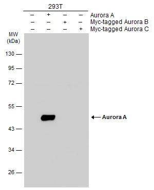Non-transfected (–) and transfected (+) 293T whole cell extracts (30 μg) were separated by 10% SDS-PAGE, and the membrane was blotted with Aurora A antibody (GTX134461) diluted at 1:5000. The HRP-conjugated anti-rabbit IgG antibody (GTX213110-01) was used to detect the primary antibody.