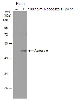 Untreated (–) and treated (+) HeLa whole cell extracts (30 μg) were separated by 10% SDS-PAGE, and the membrane was blotted with Aurora A antibody (GTX134461) diluted at 1:500. The HRP-conjugated anti-rabbit IgG antibody (GTX213110-01) was used to detect the primary antibody.