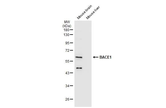 Various tissue extracts (50 μg) were separated by 10% SDS-PAGE, and the membrane was blotted with BACE1 antibody (GTX134480) diluted at 1:1000. The HRP-conjugated anti-rabbit IgG antibody (GTX213110-01) was used to detect the primary antibody.