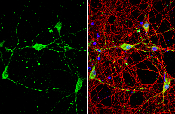 BACE1 antibody detects BACE1 protein by immunofluorescent analysis. Sample: DIV10 rat E18 primary hippocampal neuron cells were fixed in 4% paraformaldehyde at RT for 15 min. Green: BACE1 stained by BACE1 antibody (GTX134480) diluted at 1:500. Red: Tau, stained by Tau antibody [GT287] (GTX634809) diluted at 1:500. Blue: Fluoroshield with DAPI (GTX30920).