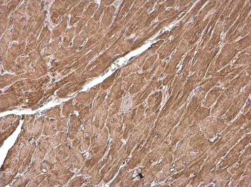 Cardiac Troponin T antibody detects Cardiac Troponin T protein at cytoplasm by immunohistochemical analysis. Sample: Paraffin-embedded mouse heart. Cardiac Troponin T stained by Cardiac Troponin T antibody (GTX134489) diluted at 1:500. Antigen Retrieval: Citrate buffer, pH 6.0, 15 min