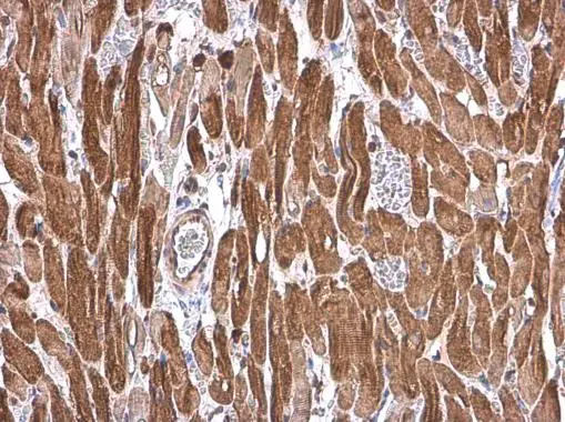 Cardiac Troponin T antibody detects Cardiac Troponin T protein at cytoplasm by immunohistochemical analysis. Sample: Paraffin-embedded rat heart. Cardiac Troponin T stained by Cardiac Troponin T antibody (GTX134489) diluted at 1:500. Antigen Retrieval: Citrate buffer, pH 6.0, 15 min