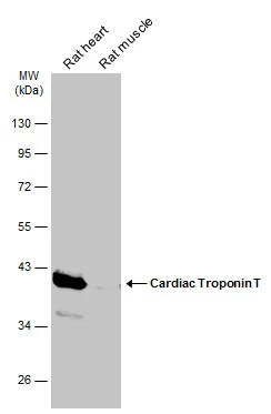 Various tissue extracts (50 μg) were separated by 10% SDS-PAGE, and the membrane was blotted with Cardiac Troponin T antibody (GTX134489) diluted at 1:1000. The HRP-conjugated anti-rabbit IgG antibody (GTX213110-01) was used to detect the primary antibody.