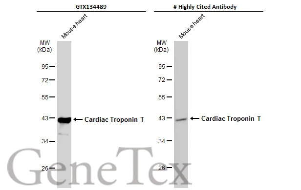 Mouse tissue extract (50 μg) was separated by 10% SDS-PAGE, and the membranes were blotted with Cardiac Troponin T antibody (GTX134489) diluted at 1:3000 and competitor's antibody diluted at 1:3000. The HRP-conjugated anti-rabbit IgG antibody (GTX213110-01) was used to detect the primary antibody. *The competitor is not affiliated with GeneTex and does not endorse this product.