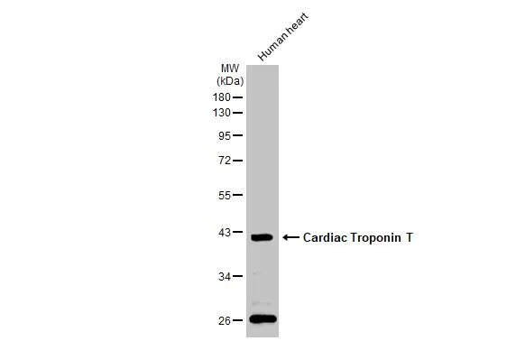 Human heart (30 μg) was separated by 10% SDS-PAGE, and the membrane was blotted with Cardiac Troponin T antibody (GTX134489) diluted at 1:1000. The HRP-conjugated anti-rabbit IgG antibody (GTX213110-01) was used to detect the primary antibody.