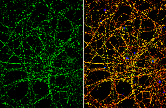 Nav1.7 antibody