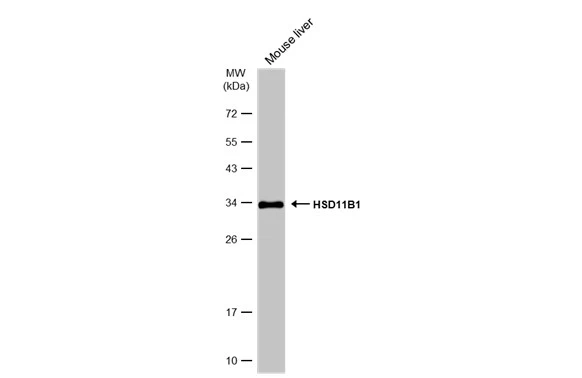 Mouse tissue extract (50 μg) were separated by 12% SDS-PAGE, and the membrane was blotted with HSD11B1 antibody (GTX134509) diluted at 1:1000. The HRP-conjugated anti-rabbit IgG antibody (GTX213110-01) was used to detect the primary antibody.