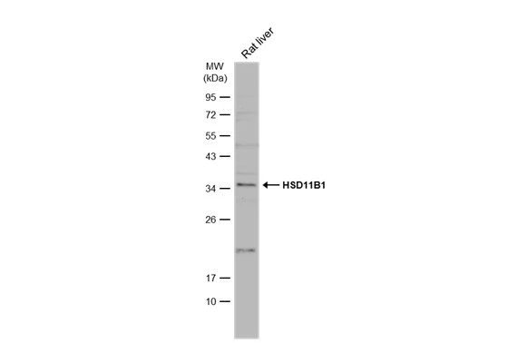 Rat tissue extract (50 μg) was separated by 12% SDS-PAGE, and the membrane was blotted with HSD11B1 antibody (GTX134509) diluted at 1:1000. The HRP-conjugated anti-rabbit IgG antibody (GTX213110-01) was used to detect the primary antibody, and the signal was developed with Trident ECL plus-Enhanced.