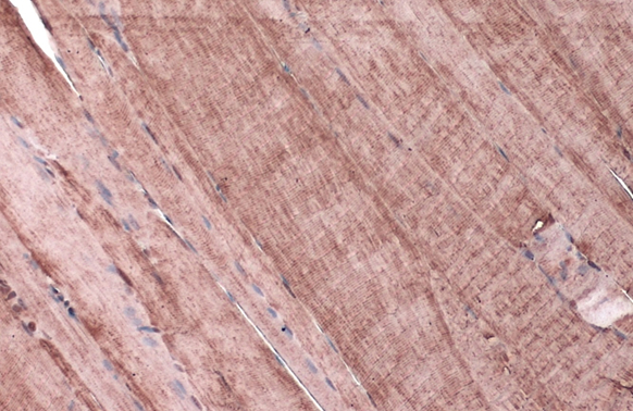 HSD11B1 antibody detects HSD11B1 protein at cytoplasm by immunohistochemical analysis. Sample: Paraffin-embedded rat muscle. HSD11B1 stained by HSD11B1 antibody (GTX134509) diluted at 1:500. Antigen Retrieval: Citrate buffer, pH 6.0, 15 min